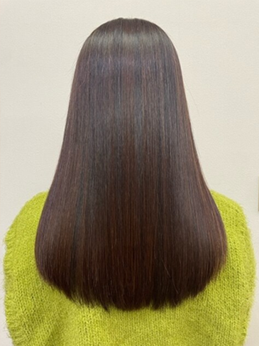 施術後の仕上がり